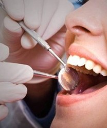 洗牙后的护理很重要  这些方法帮你搞定敏感牙