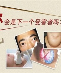 甲亢如何预防 如何能预防甲亢