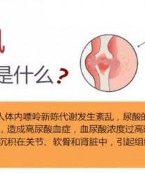 有人偷吃了这个，结果痛到不能自理！美国总统也有过同样的经历……